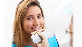 Most Commonly Asked Questions About Dental Veneers